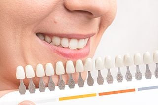 Teeth Whitening 1