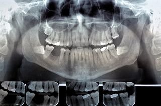 Digital X Rays 1