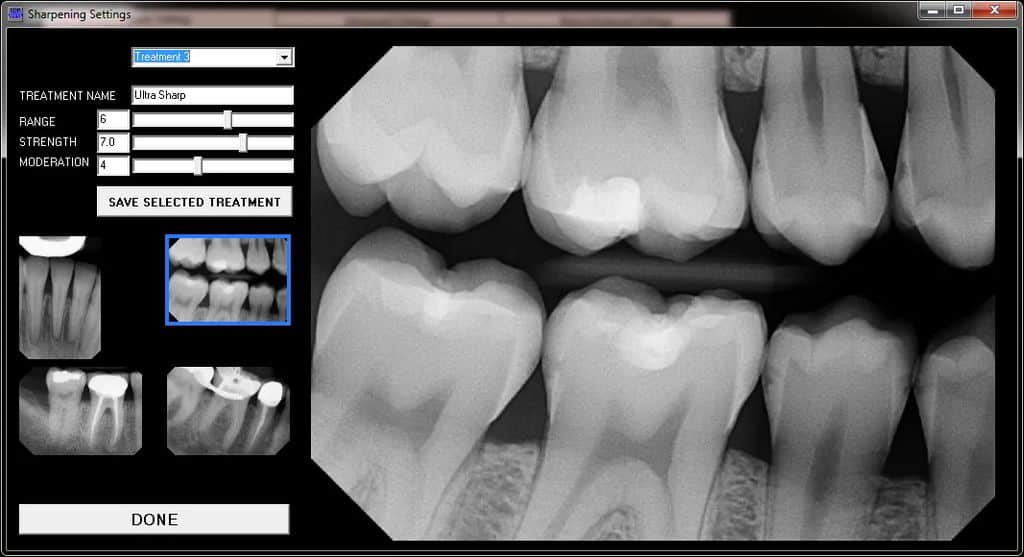 Digital X Rays 2