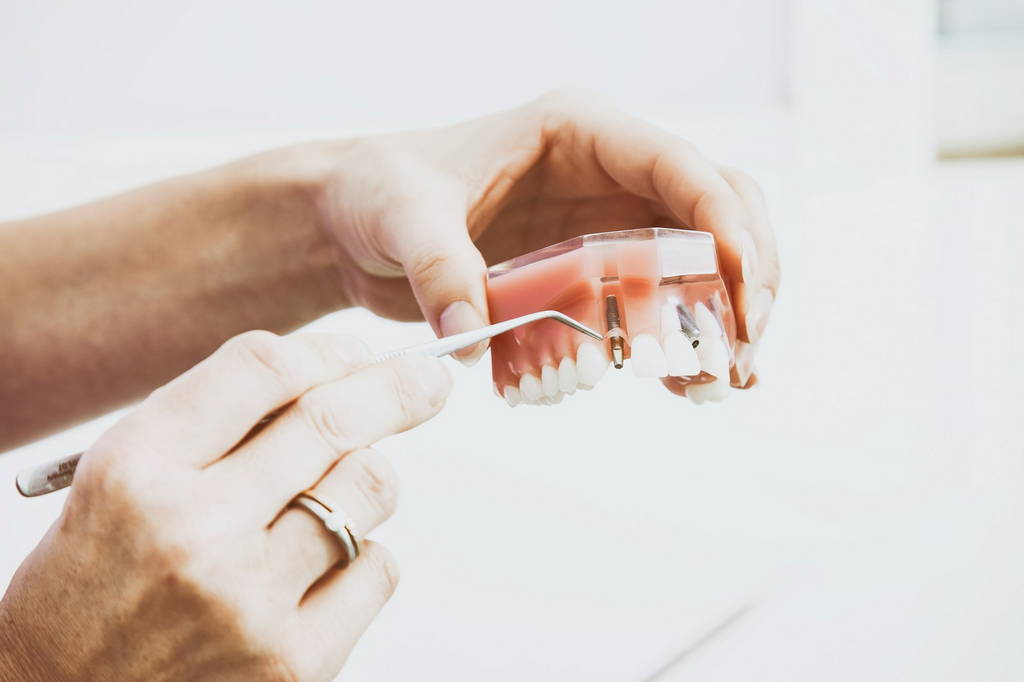 Dental Implants in Bee Caves