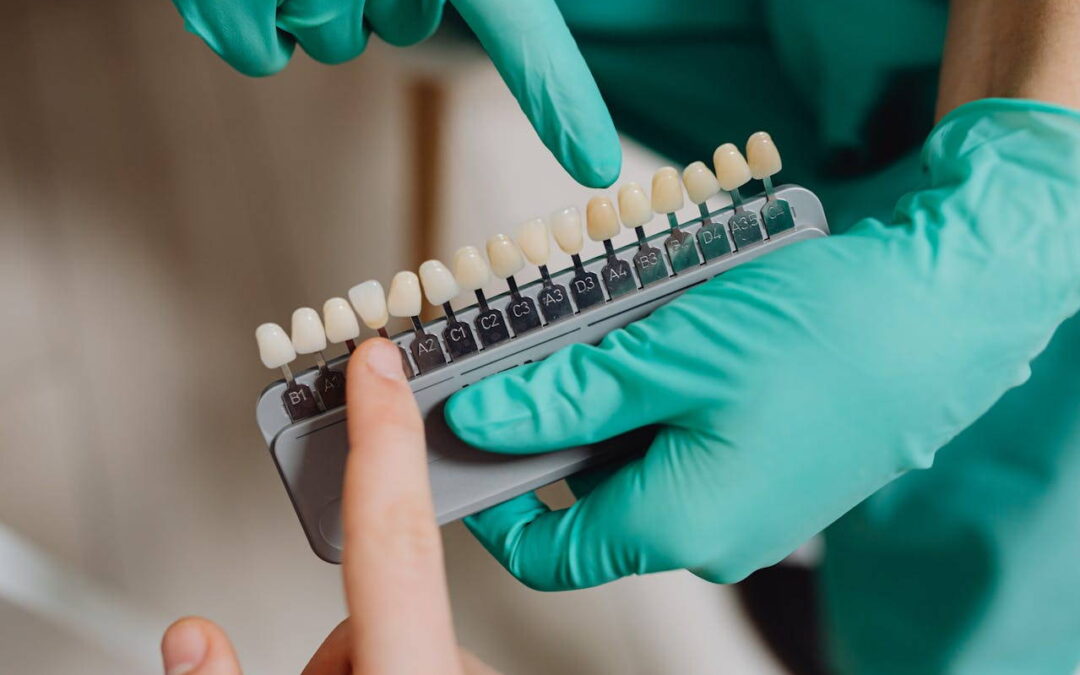 Cosmetic Dentistry in Lake Travis: Veneers and/or Whitening