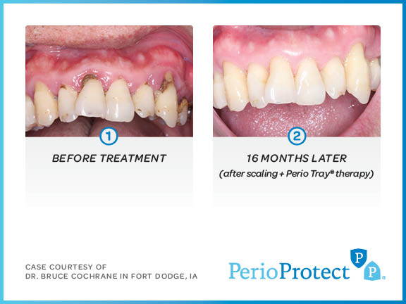 How Oral Health Affects Overall Health 1