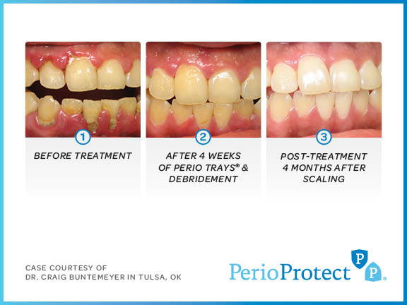 How Oral Health Affects Overall Health 2