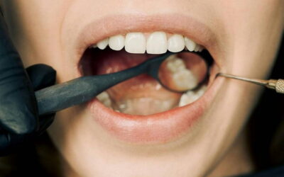 It Starts with the Mouth: How Oral Health Impacts Overall Health