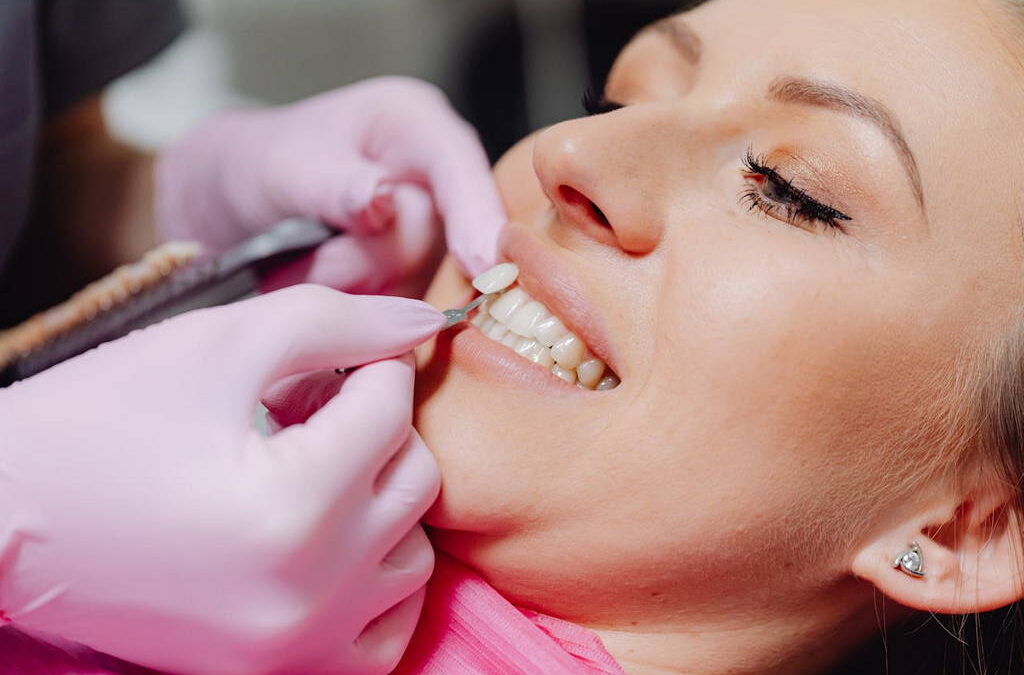 Porcelain Veneers in Bee Caves: Are They Worth It?