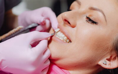 Porcelain Veneers in Bee Caves: Are They Worth It?