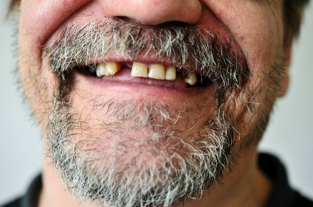 man’s face with a smiling toothless