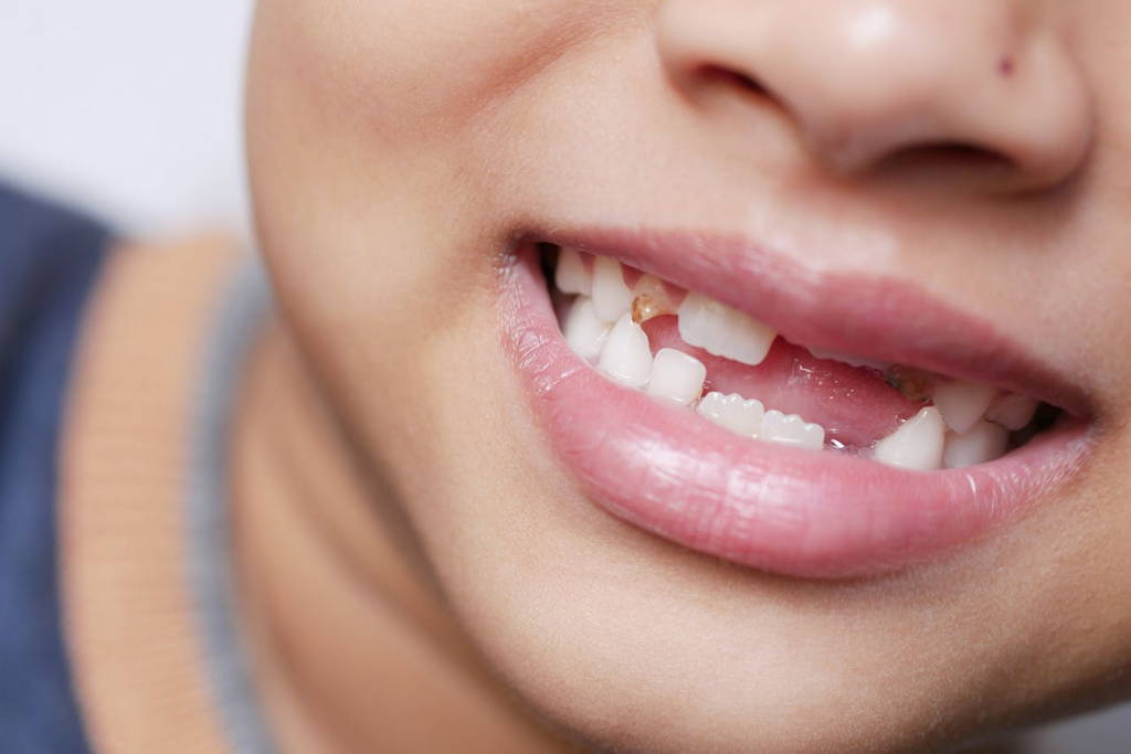 Pediatric Dental Care in Lake Travis 3