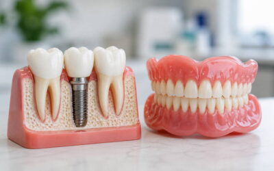 Dental Implants vs Dentures in Lakeway: Which Is Right for You?